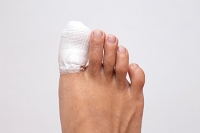 How Are Broken Toes Diagnosed?