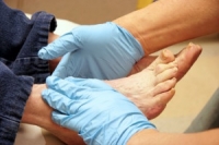 Serious Foot Conditions Caused By Diabetes